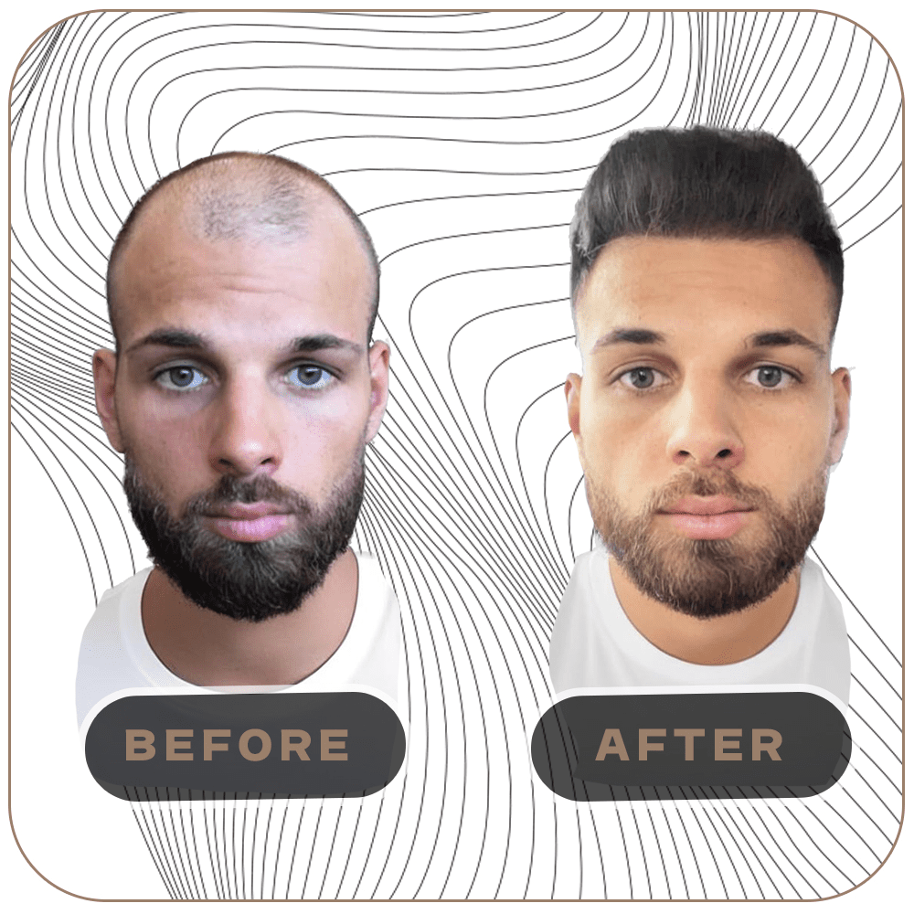 before after