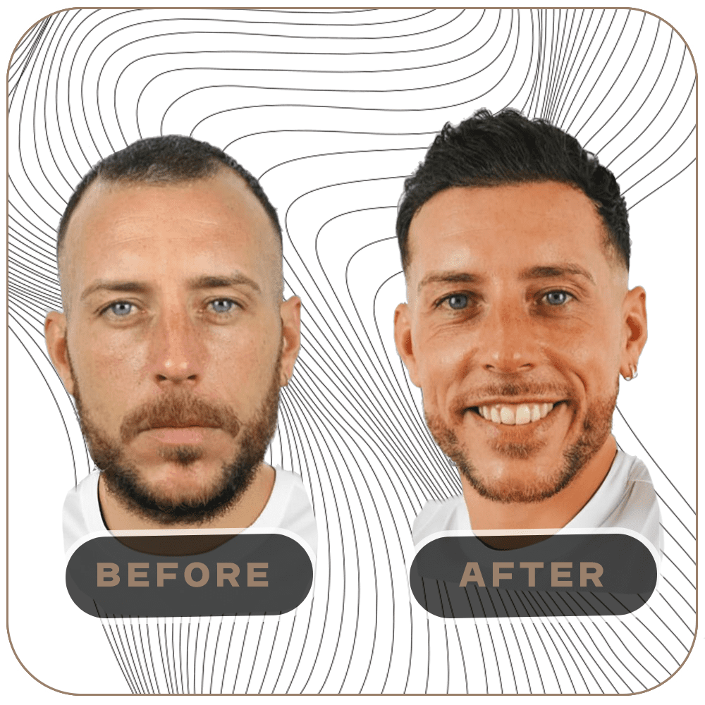 before after